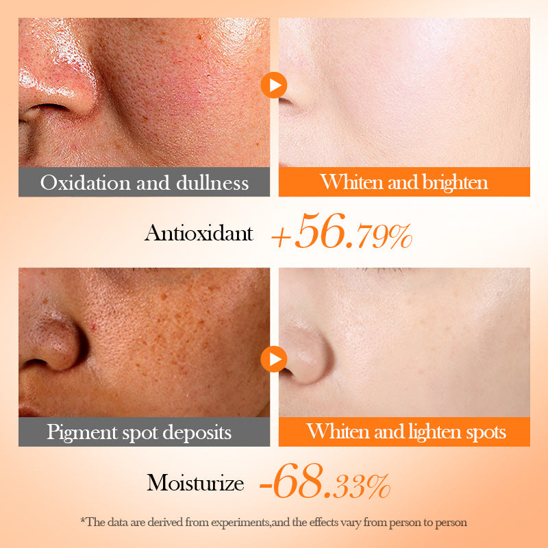 Vitamin C Whitening Six-piece Anti-oxidation Moisturizing Skin Care Gift Box