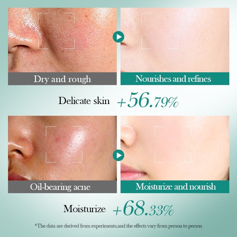 Hyaluronic Acid Moisturizing Repair Firming Skin Care Gift Suit